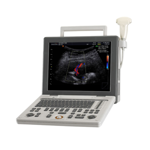 Samsung Medison SonoAce R3 Portable Ultrasound System