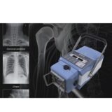 SR-8100 Medical portable X-ray